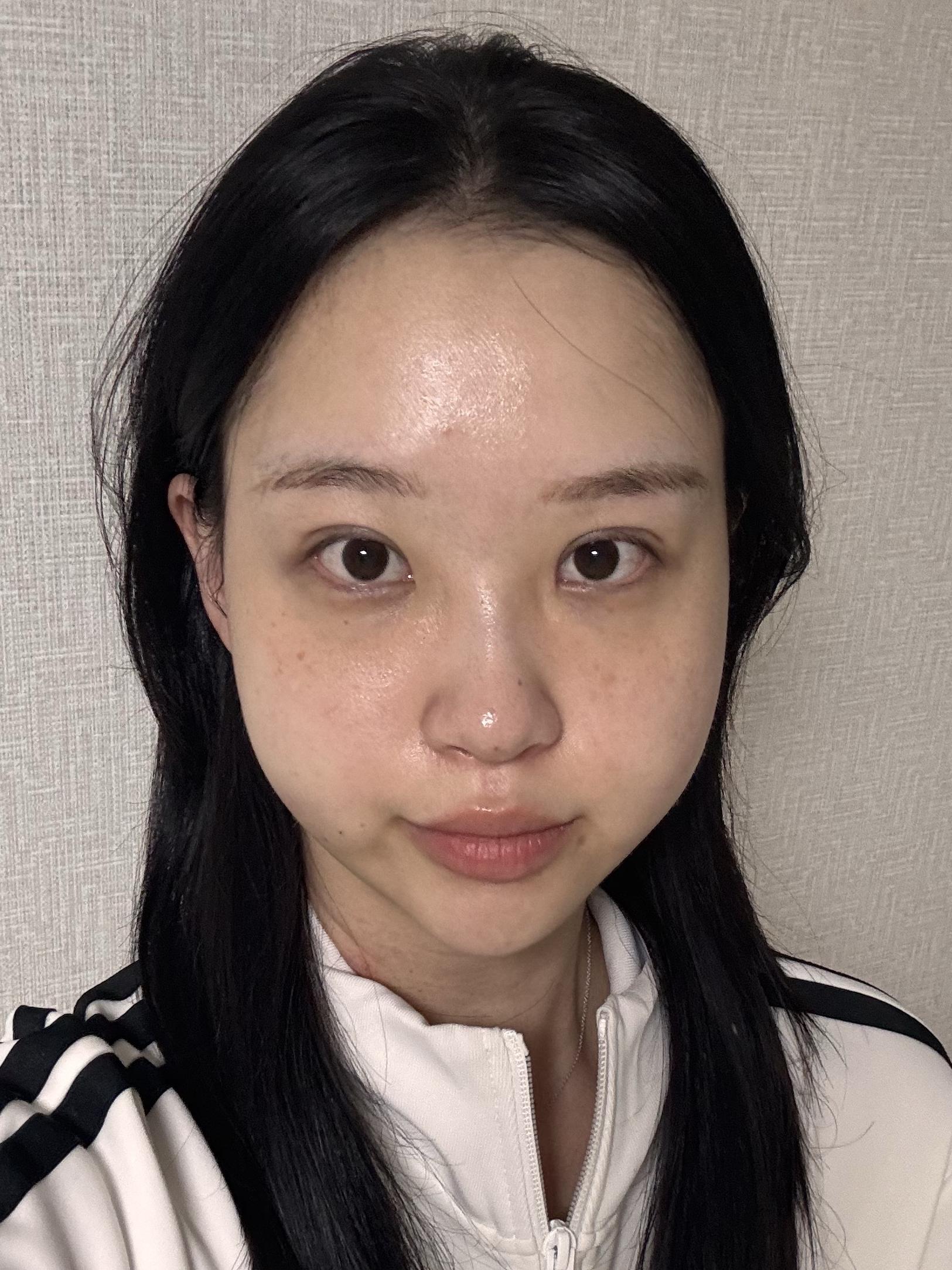 後