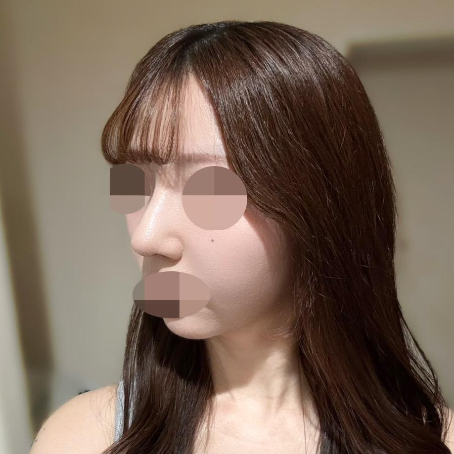 後