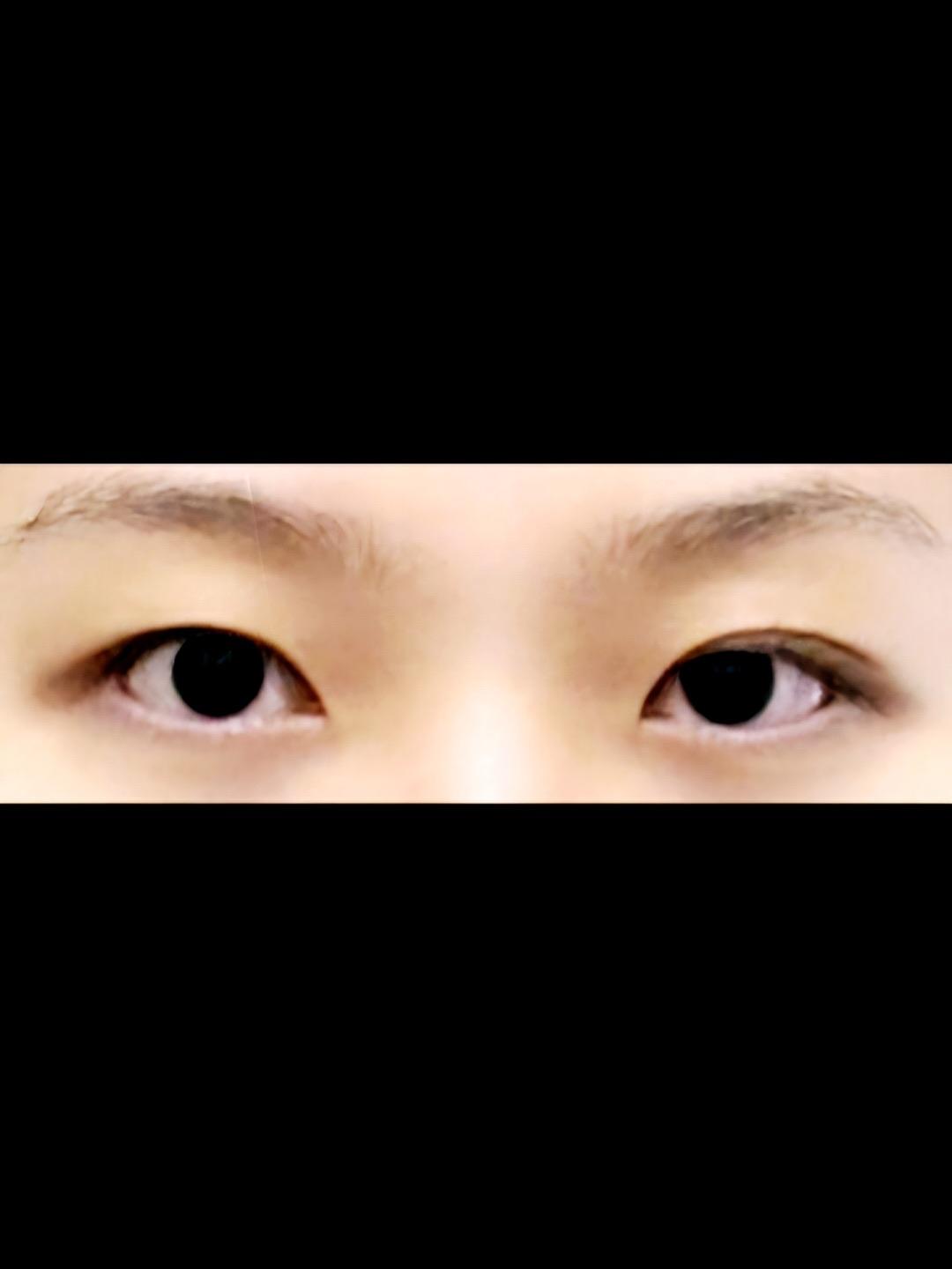 後