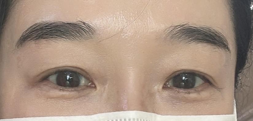 後