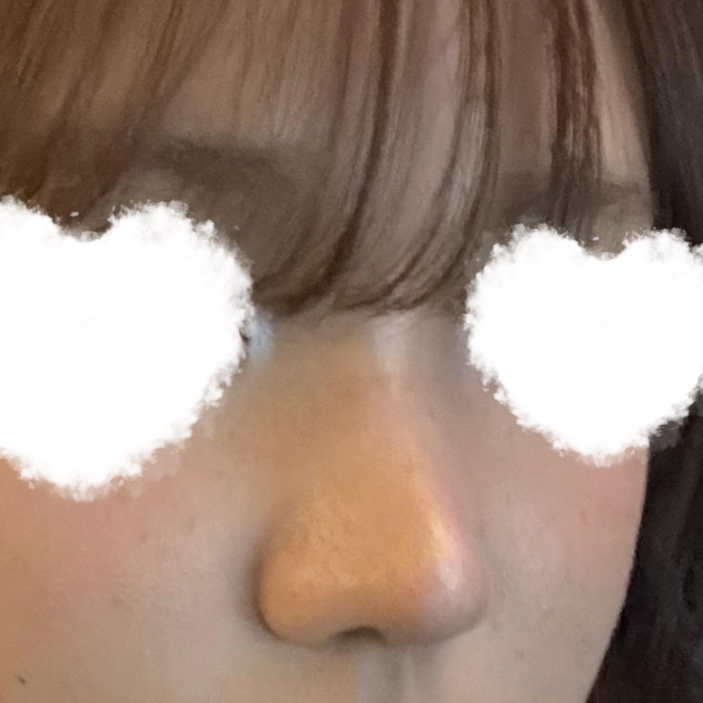 後