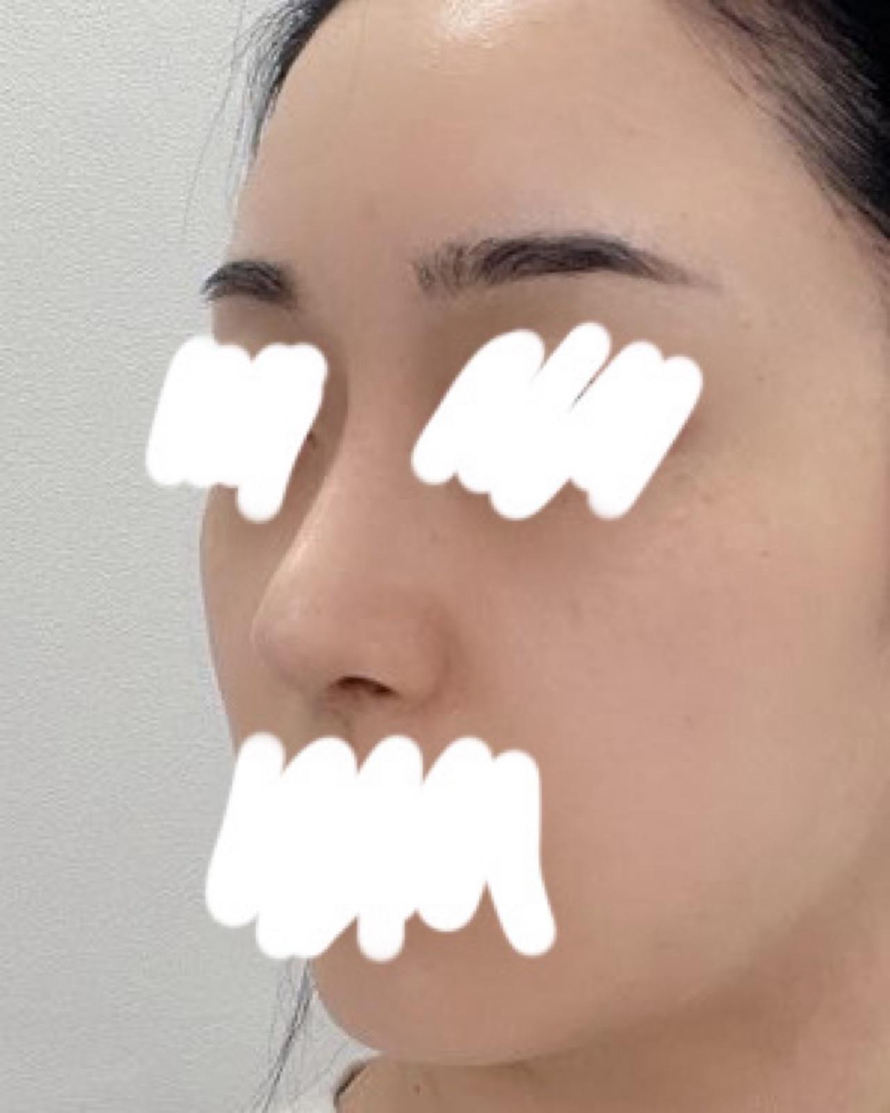 後