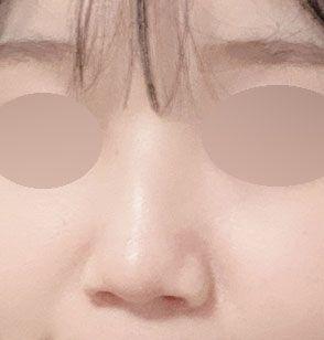 後