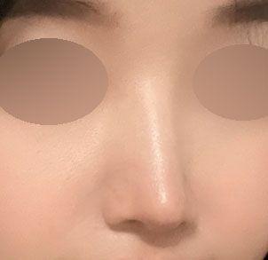後