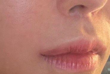 後