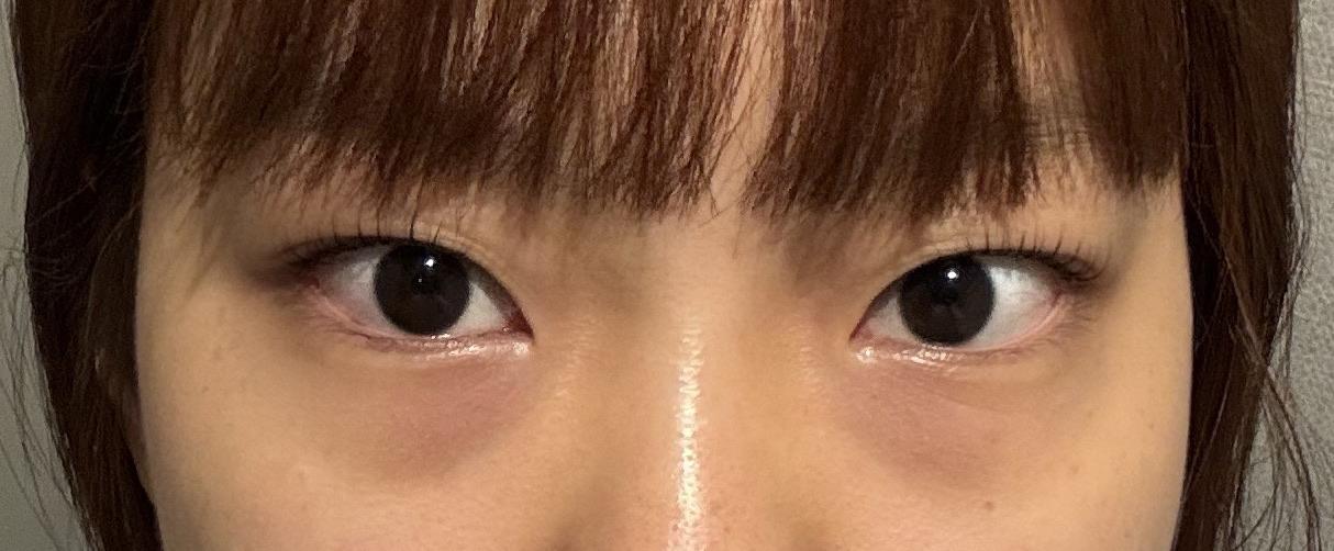 後