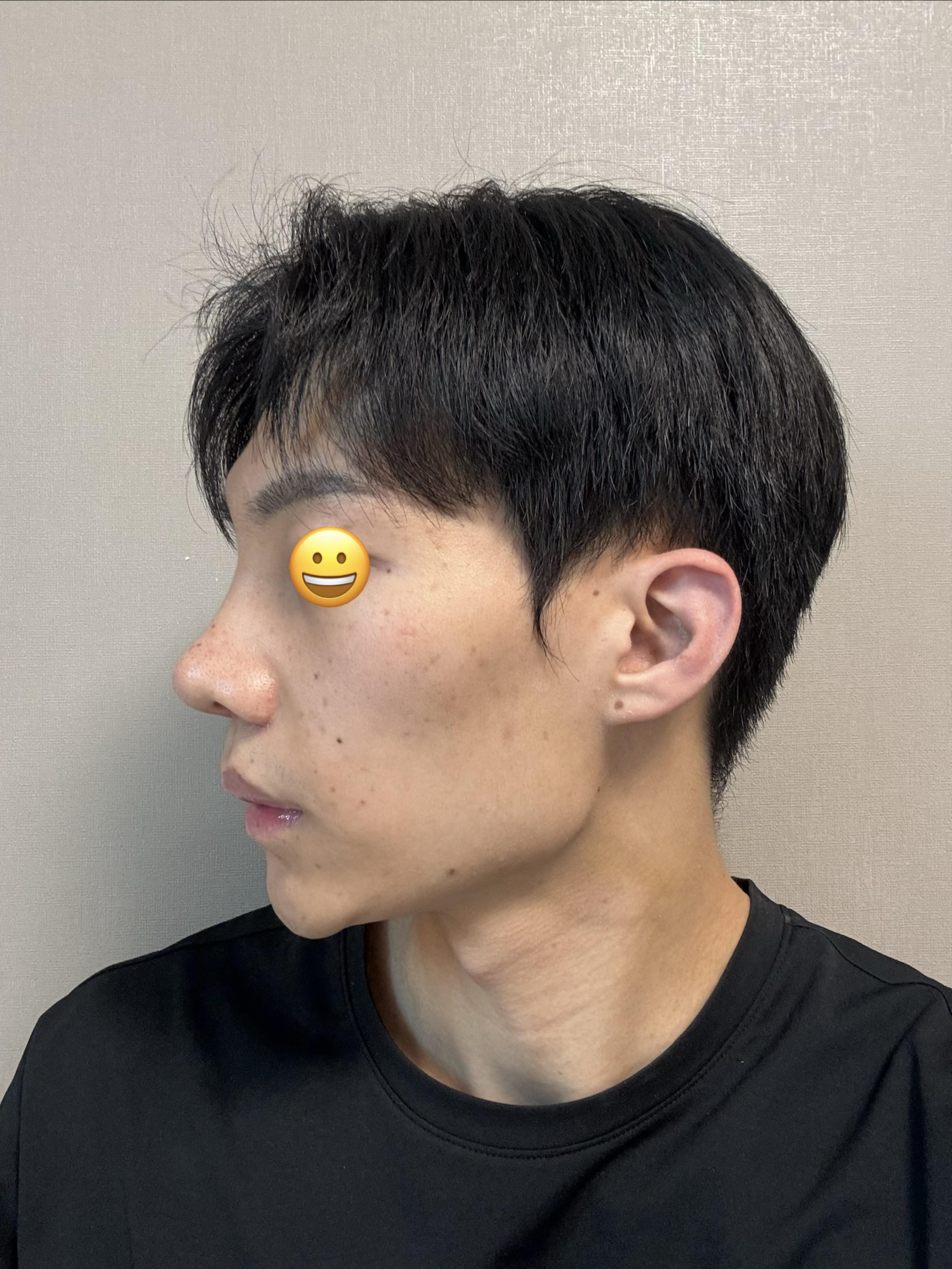 後