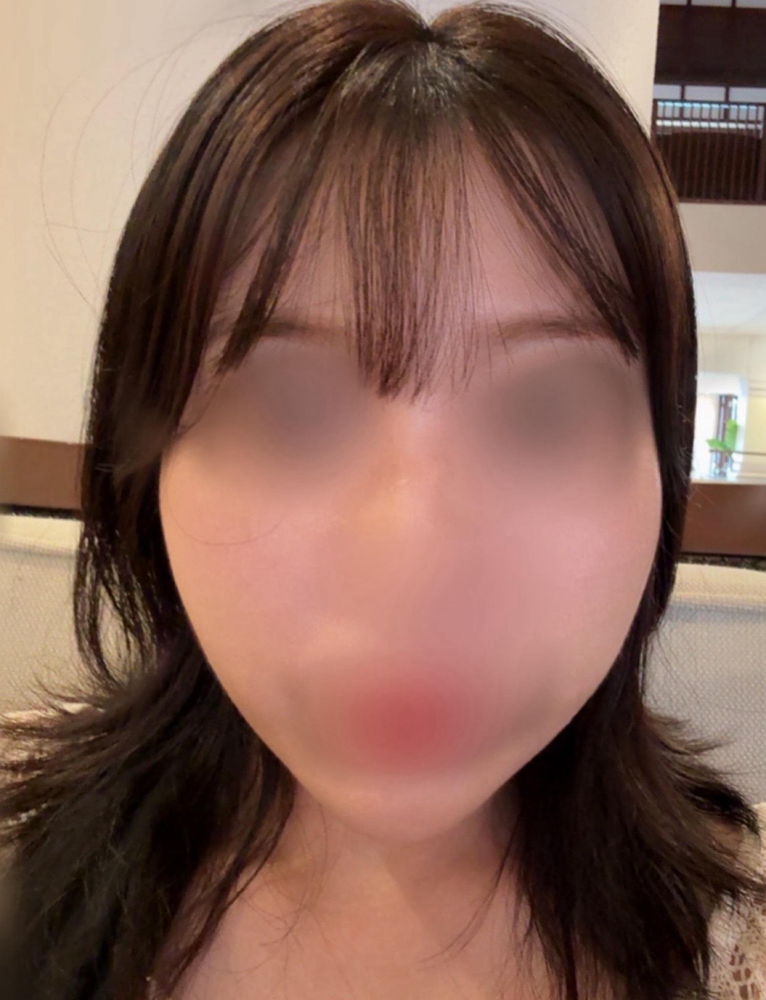 後