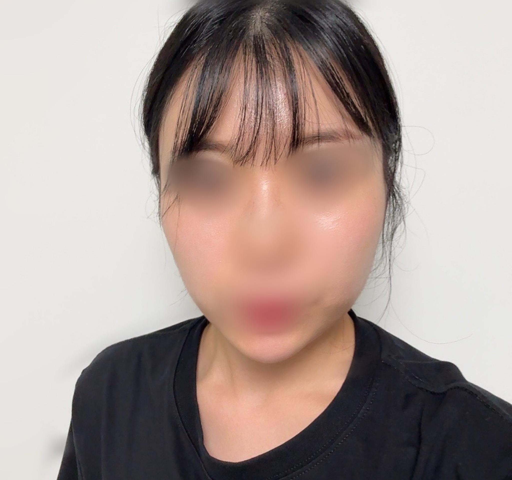後