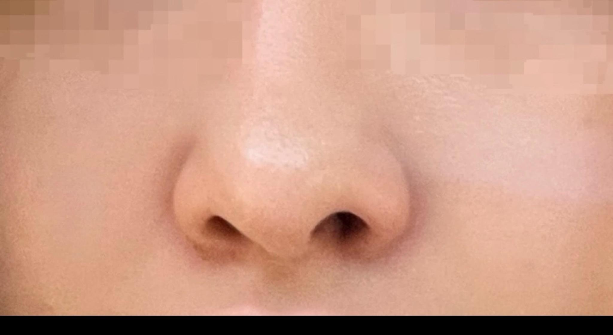 後