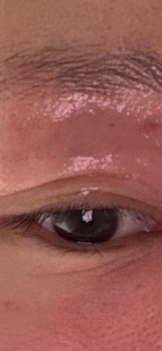 后