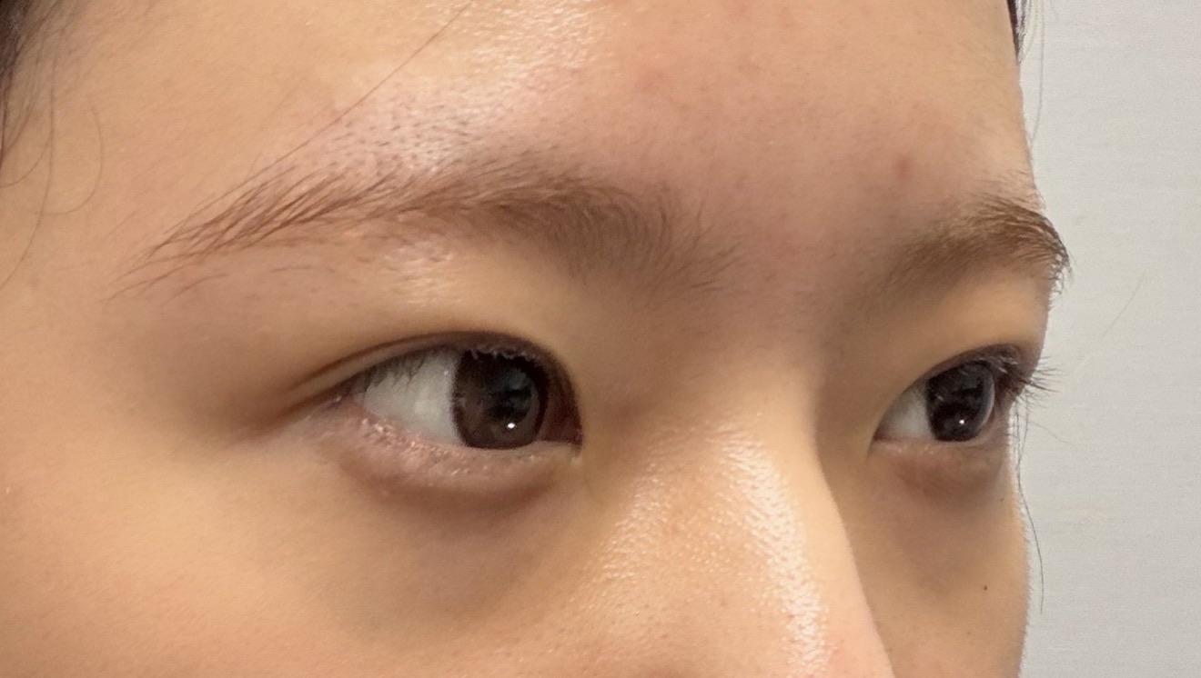 後