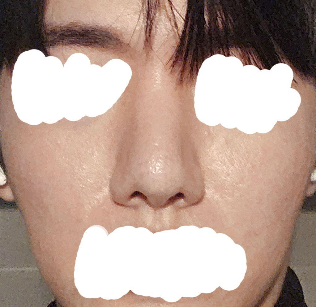 後