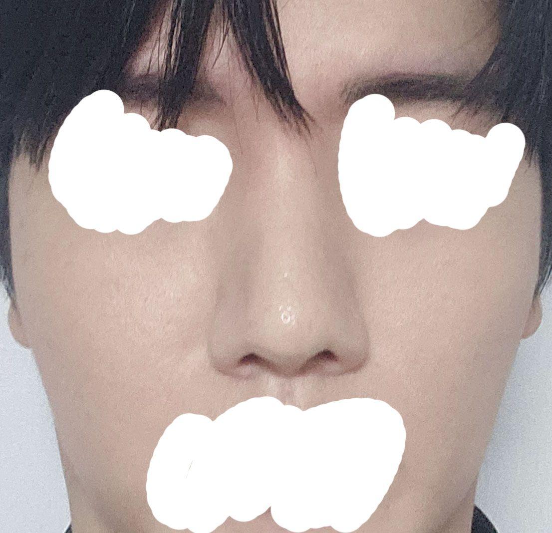 後