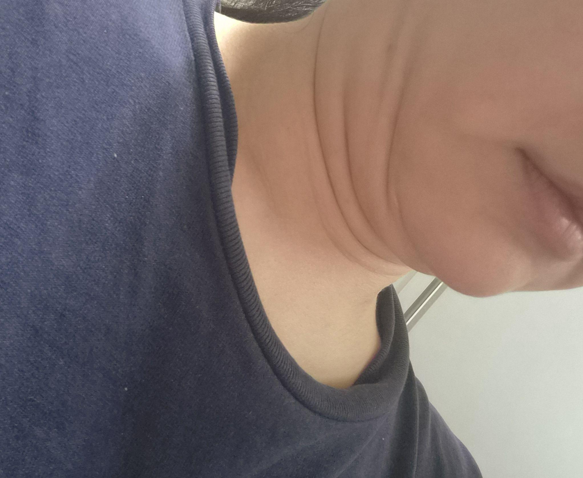 後
