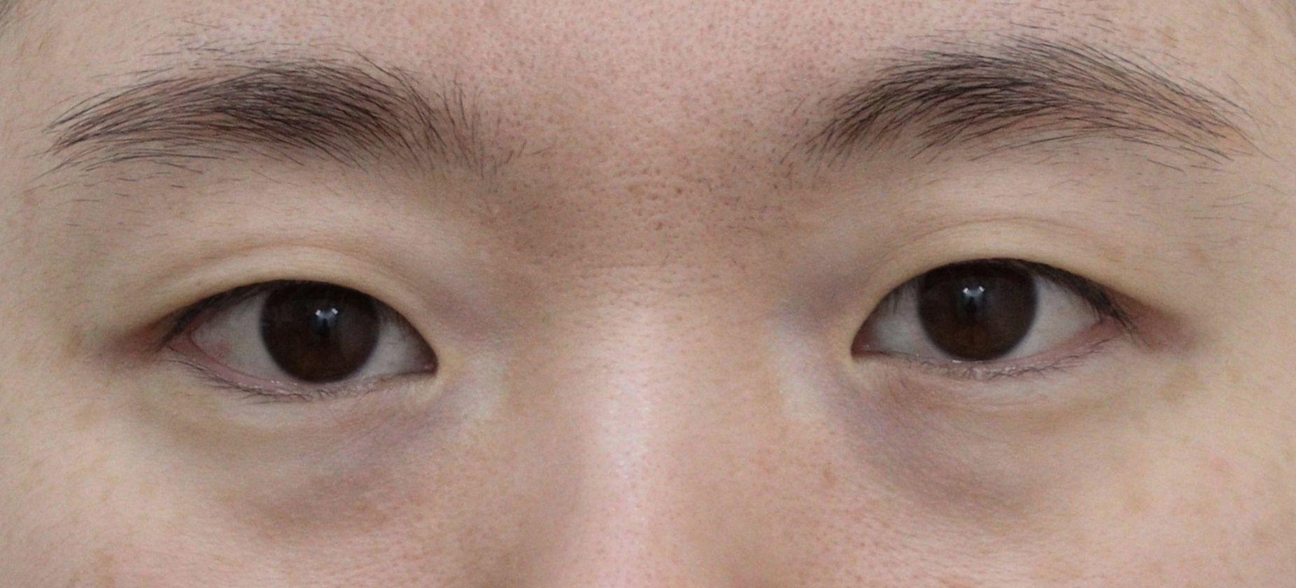 前