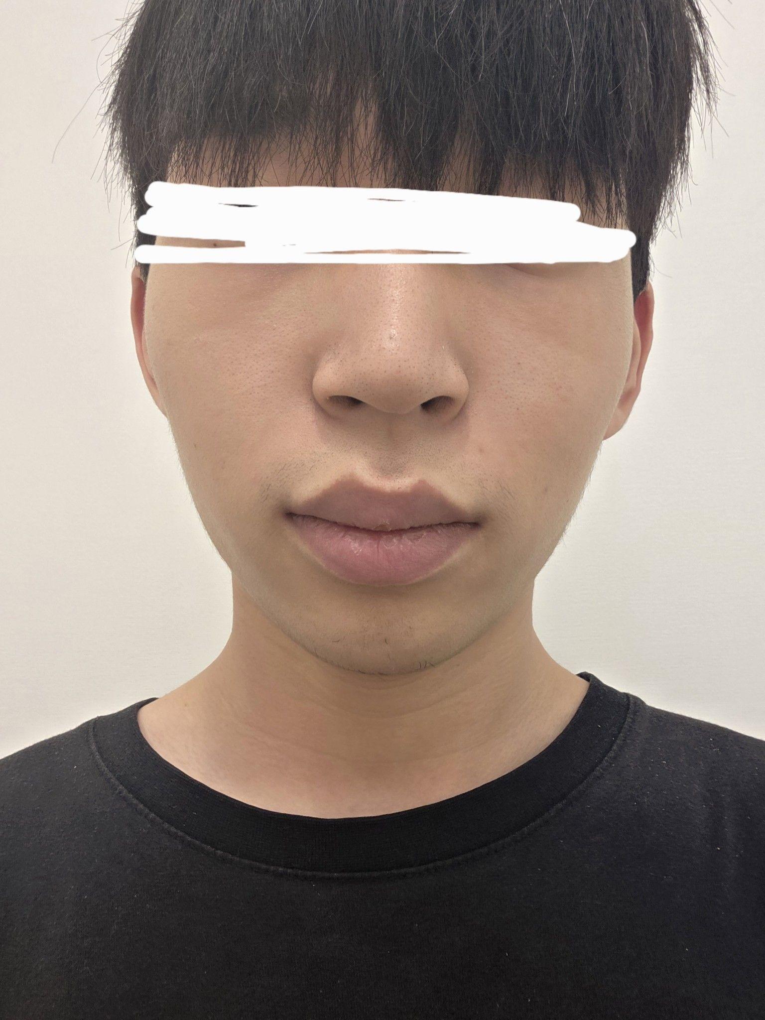 前