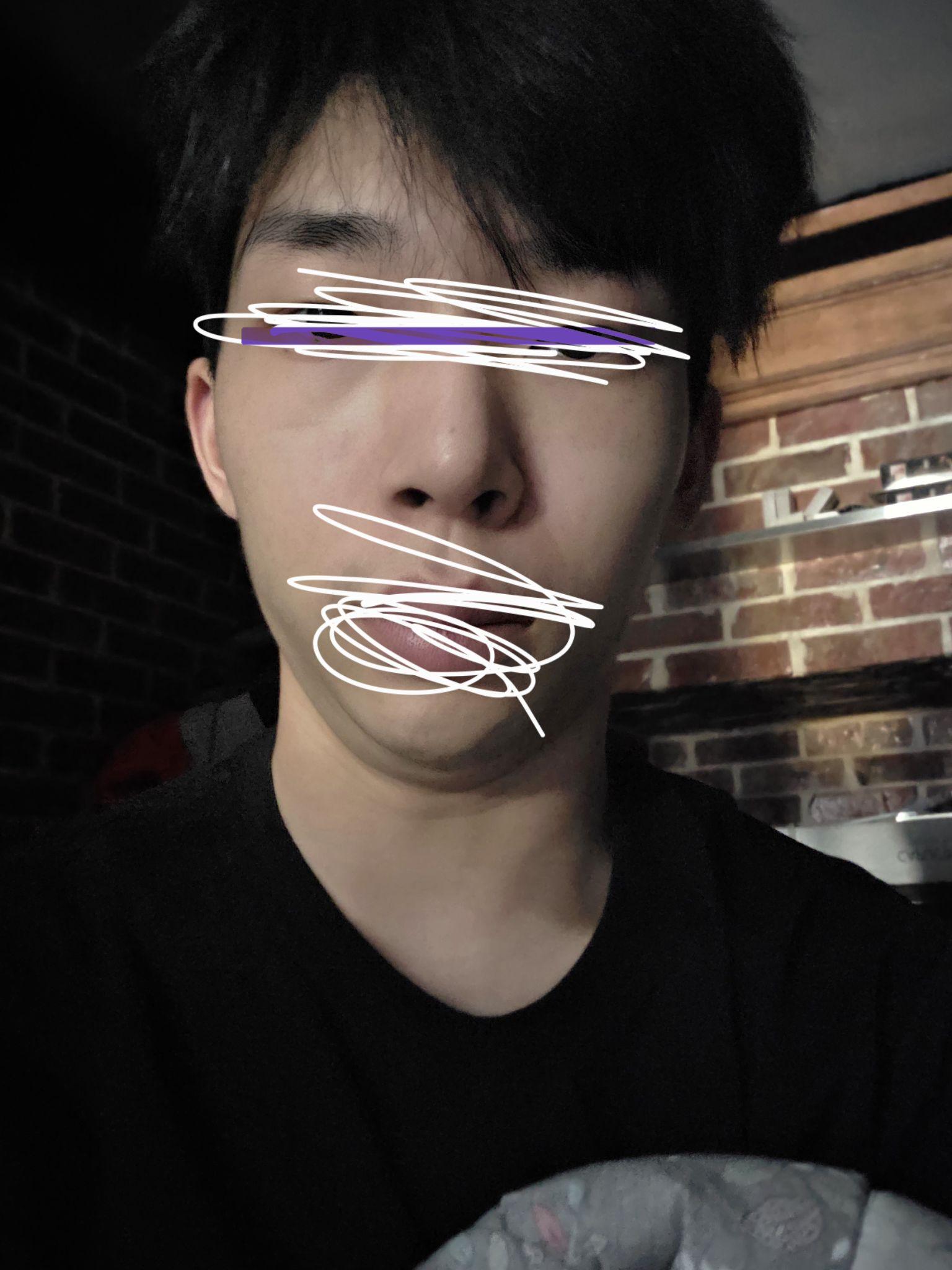 後