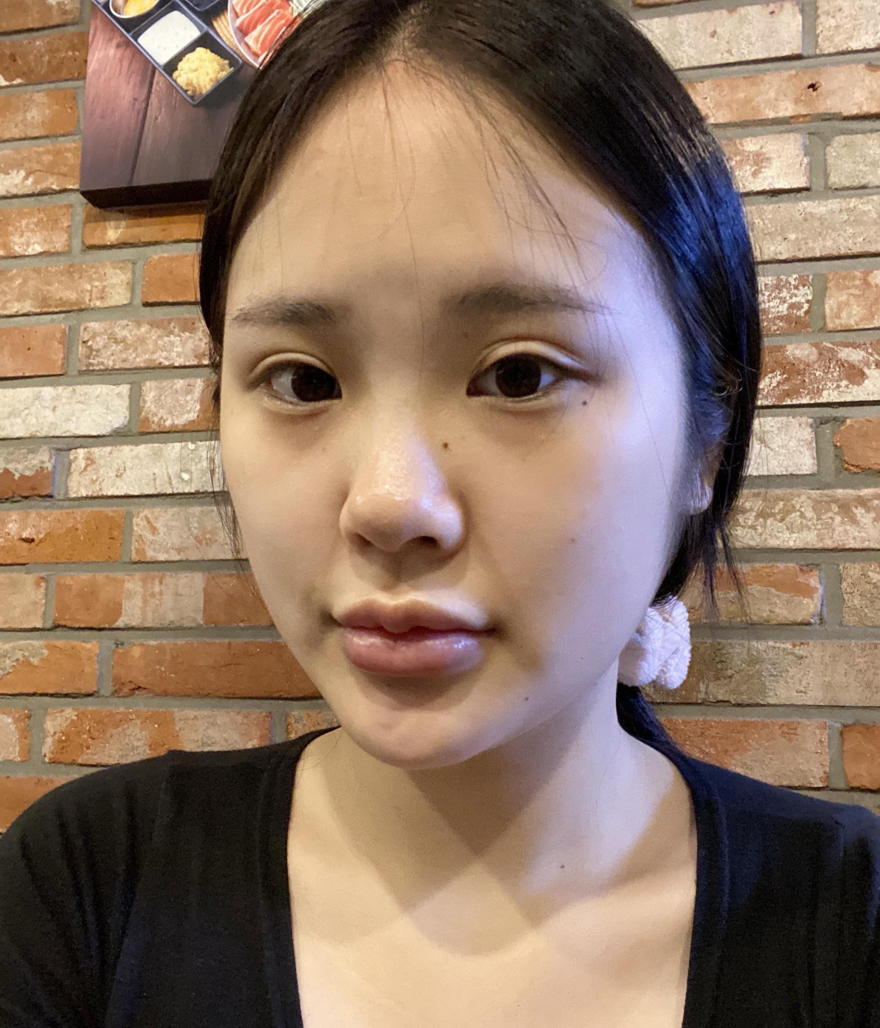 後