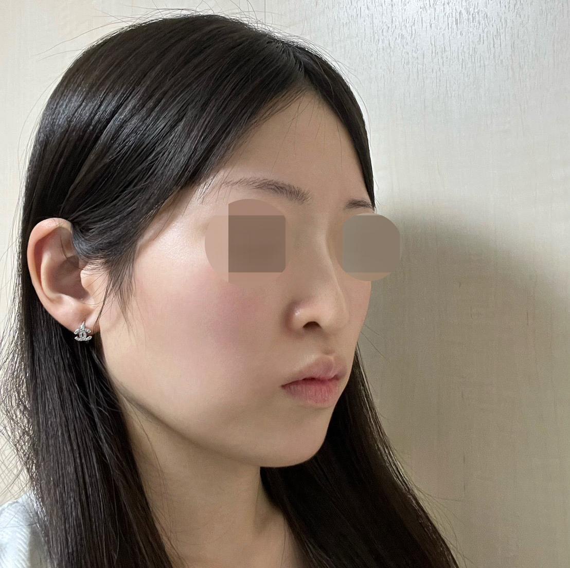 後