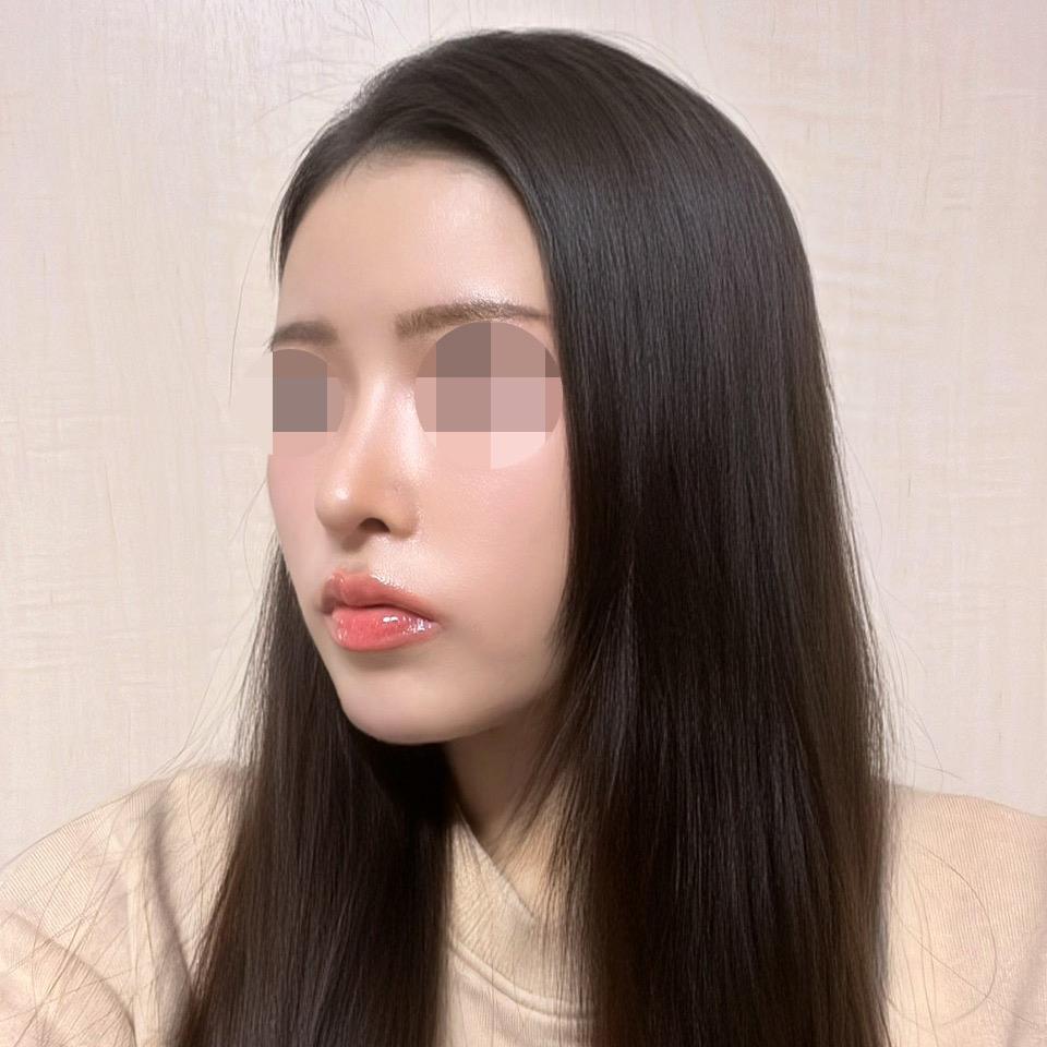 後