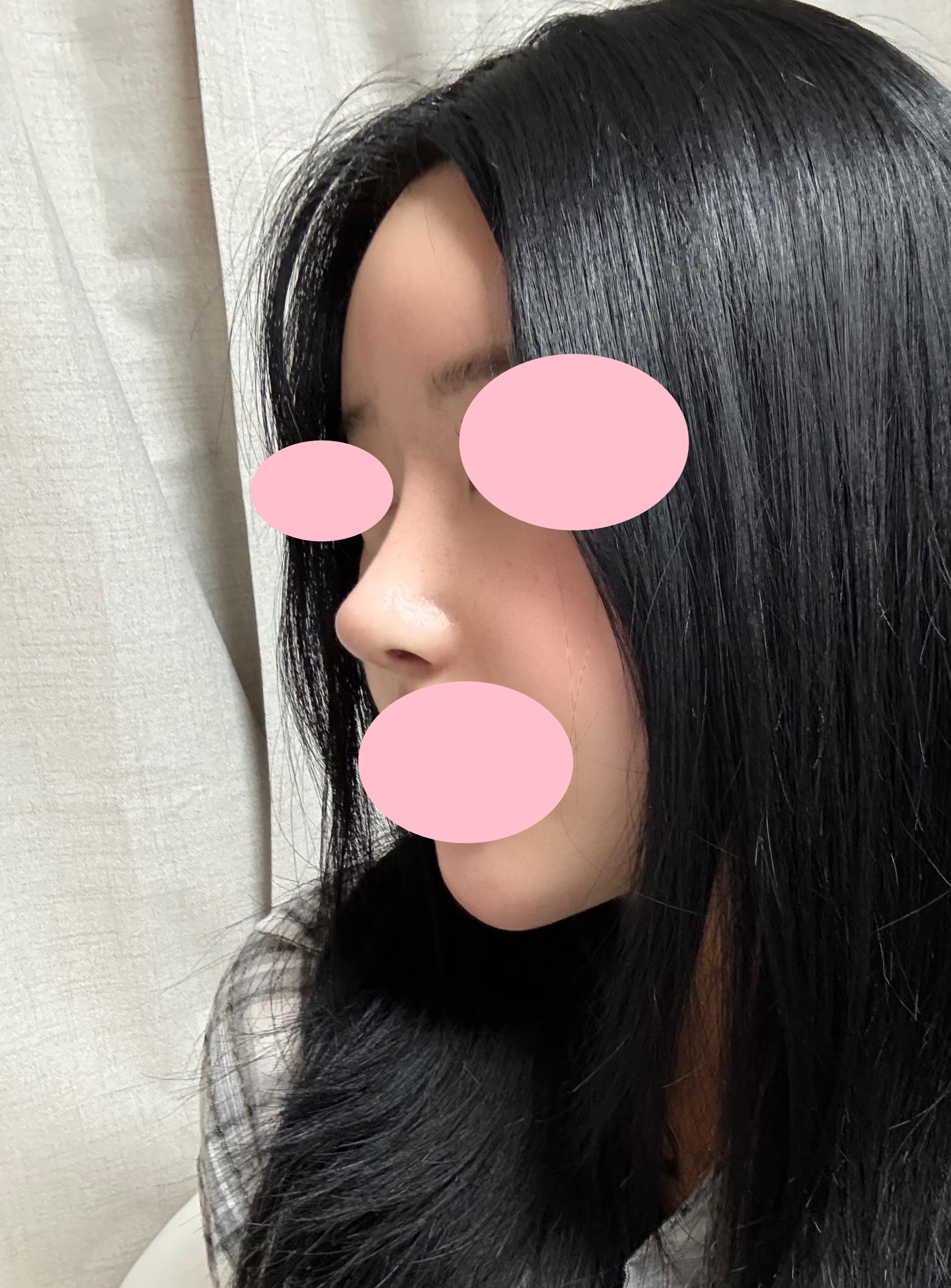 後