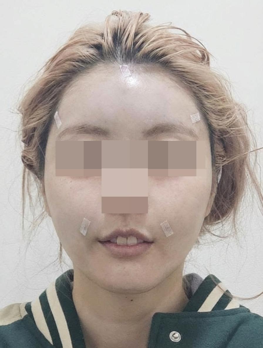 後