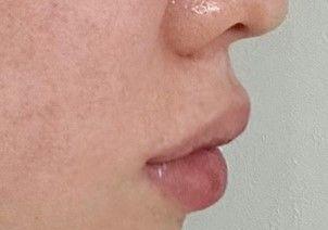 後