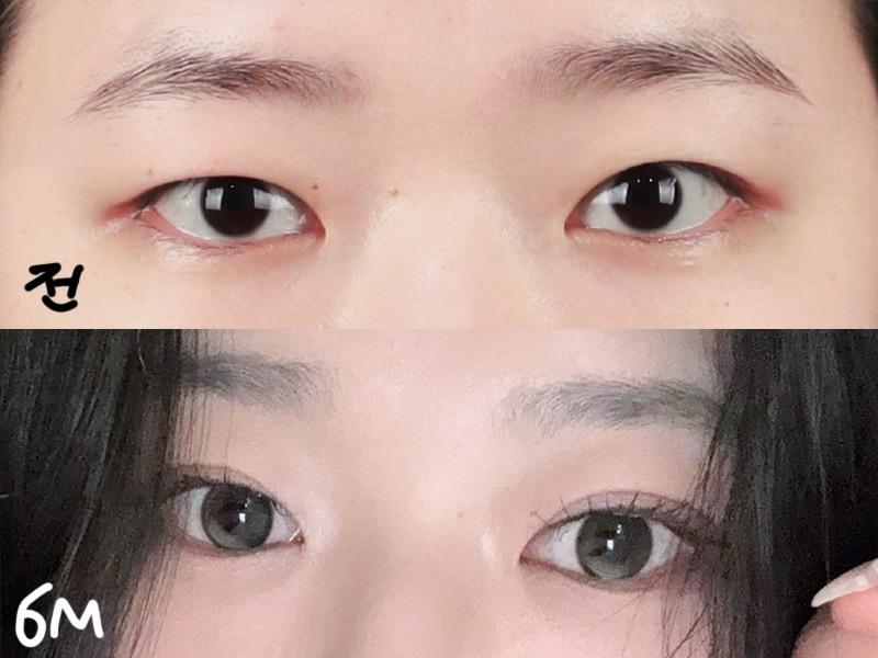 後