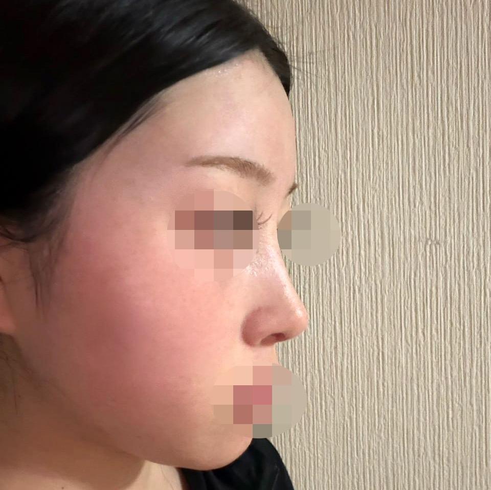 後