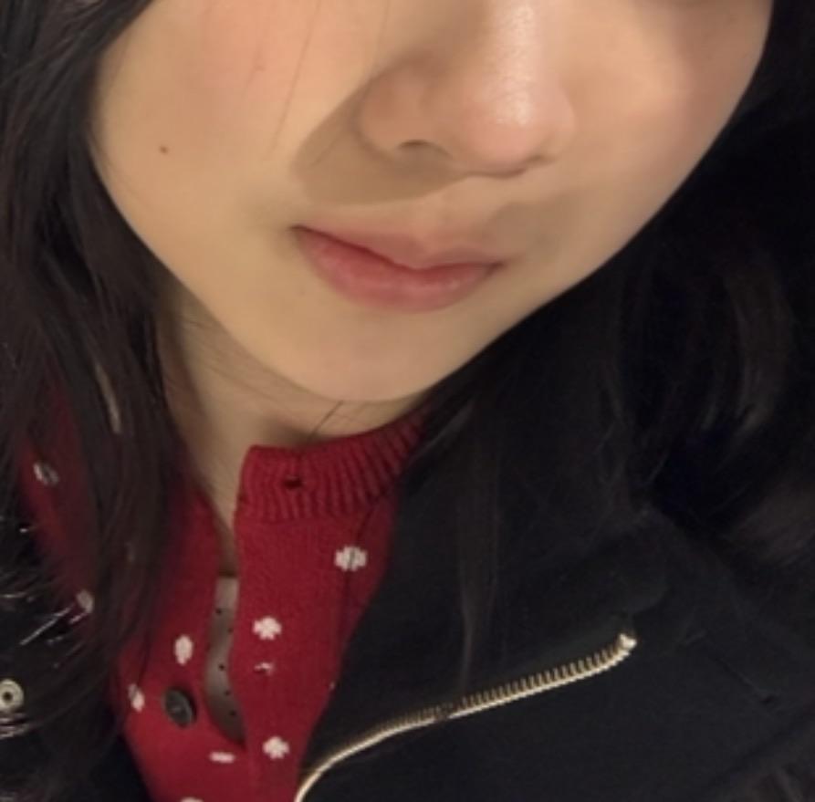 前