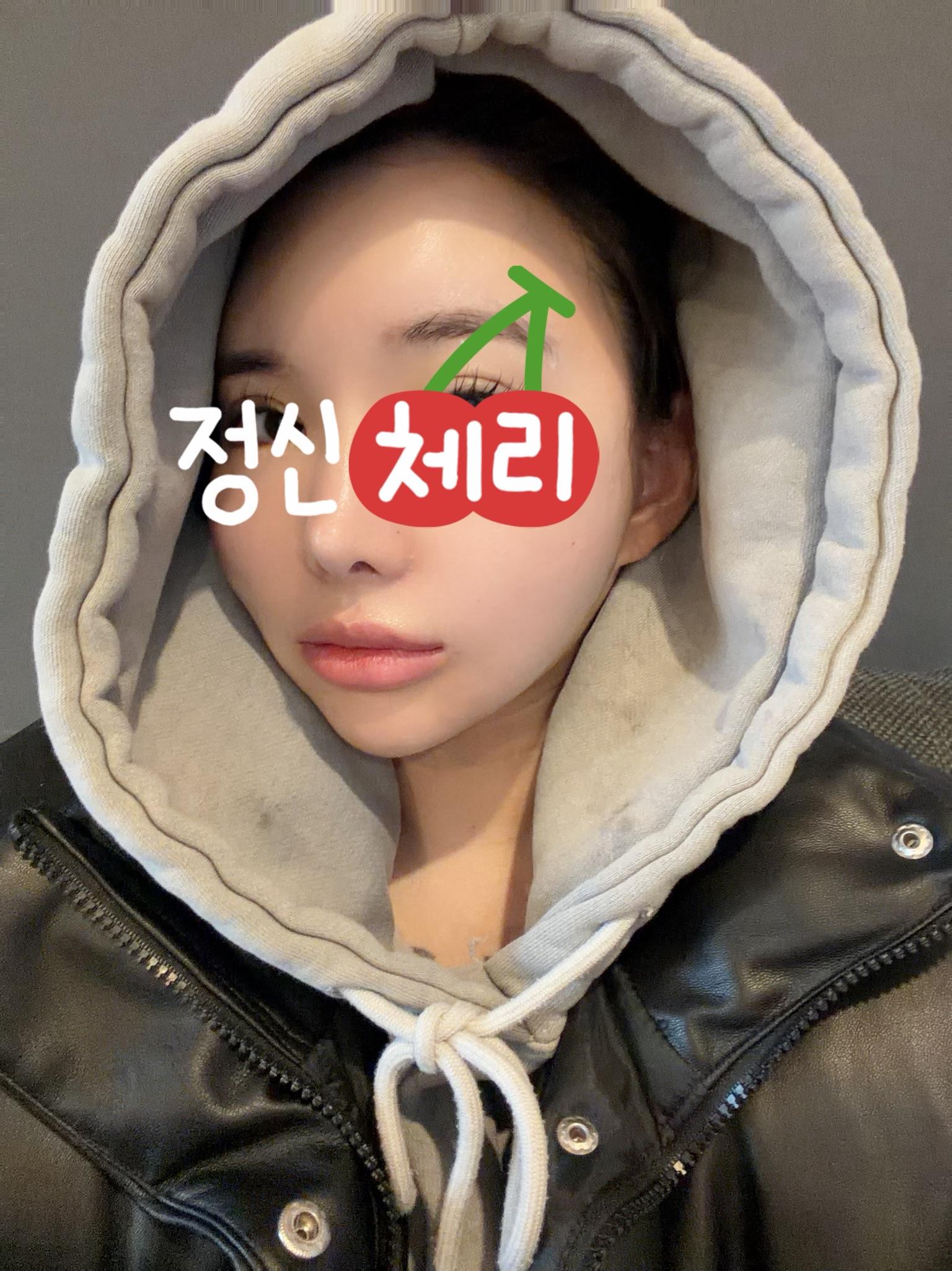 後