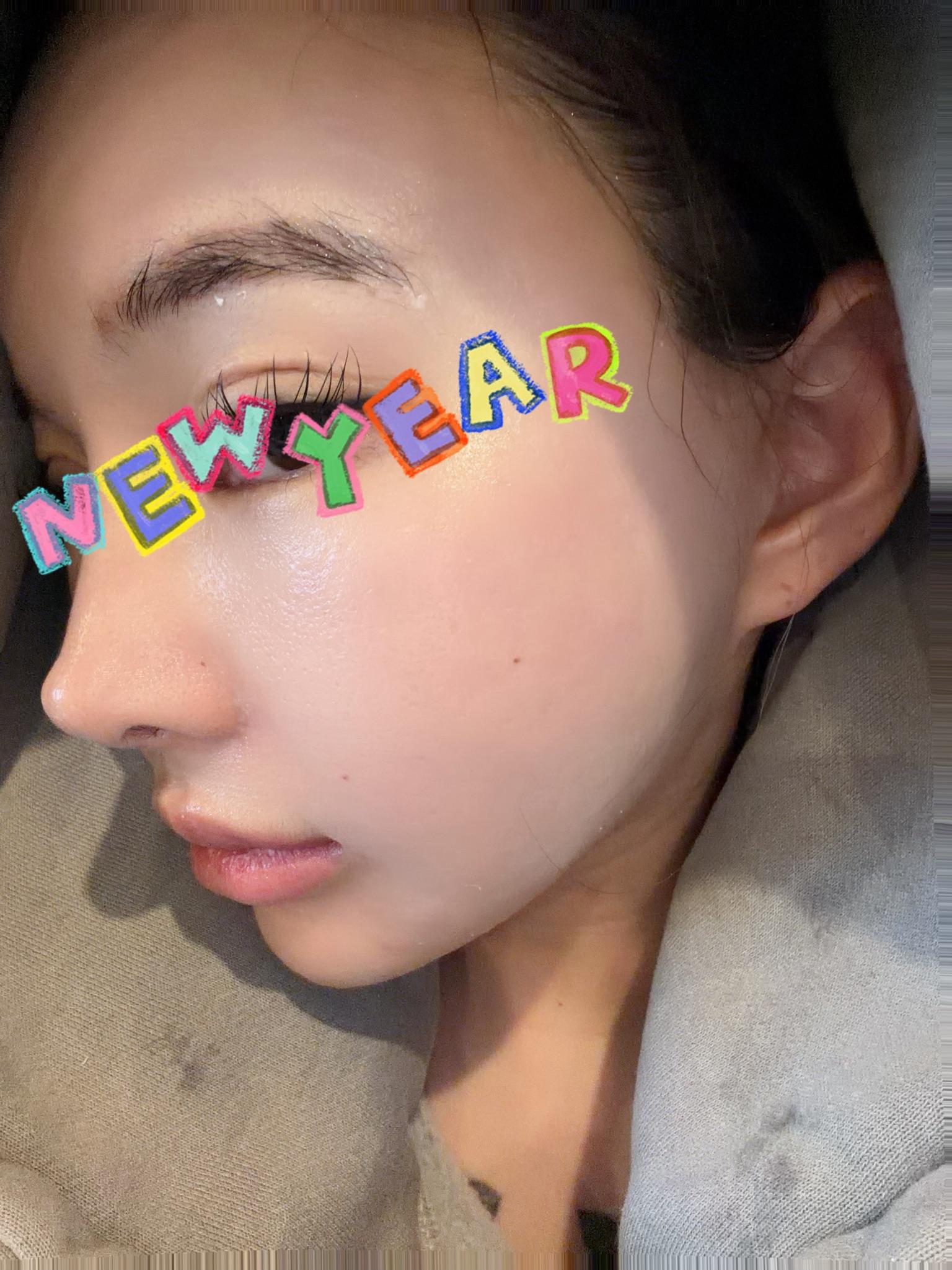 後