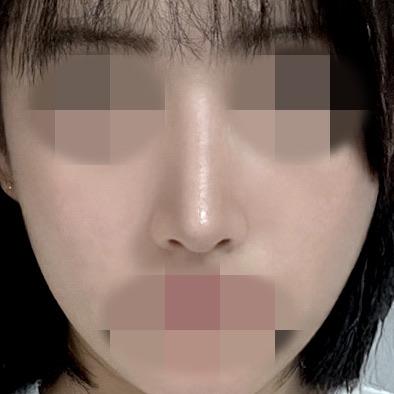 后