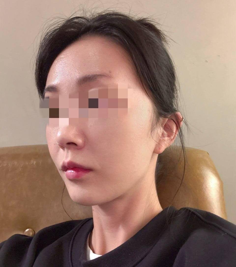 後