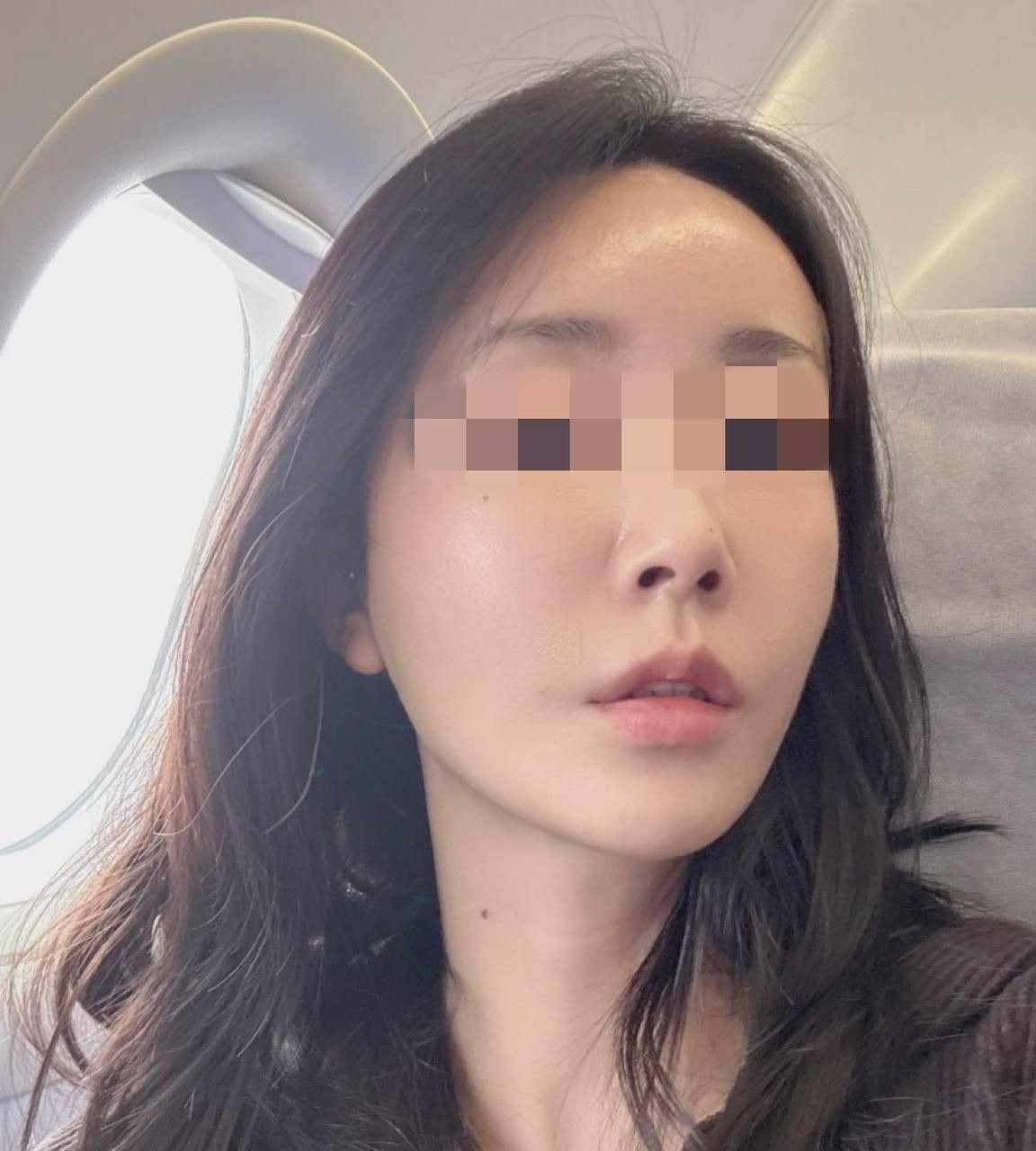 後