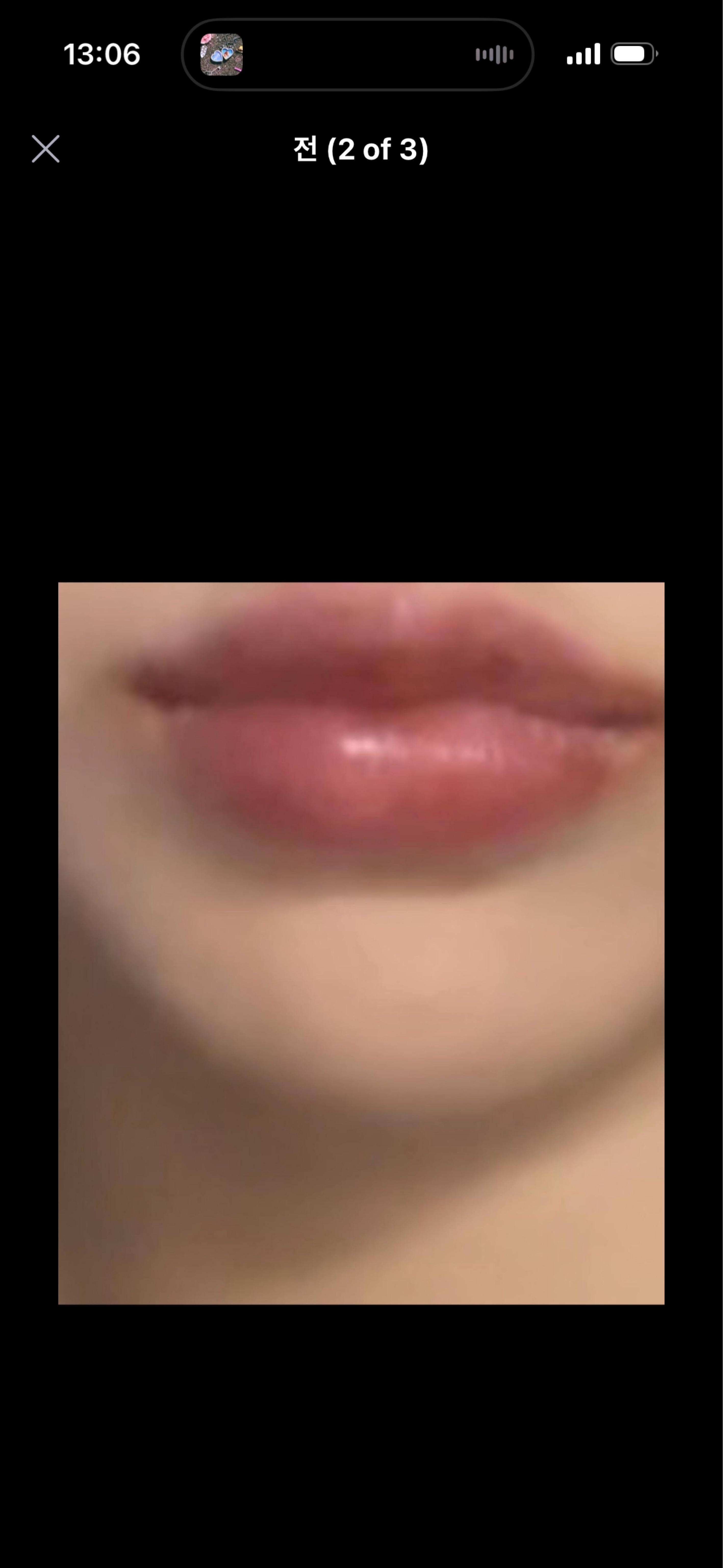 後