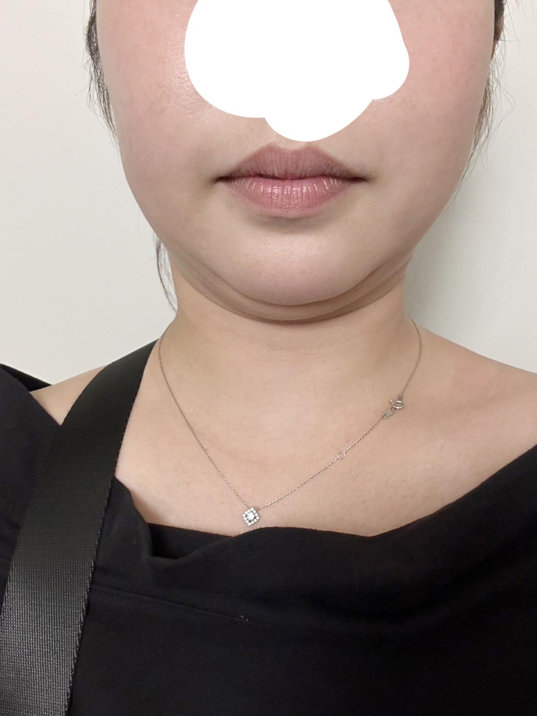 後