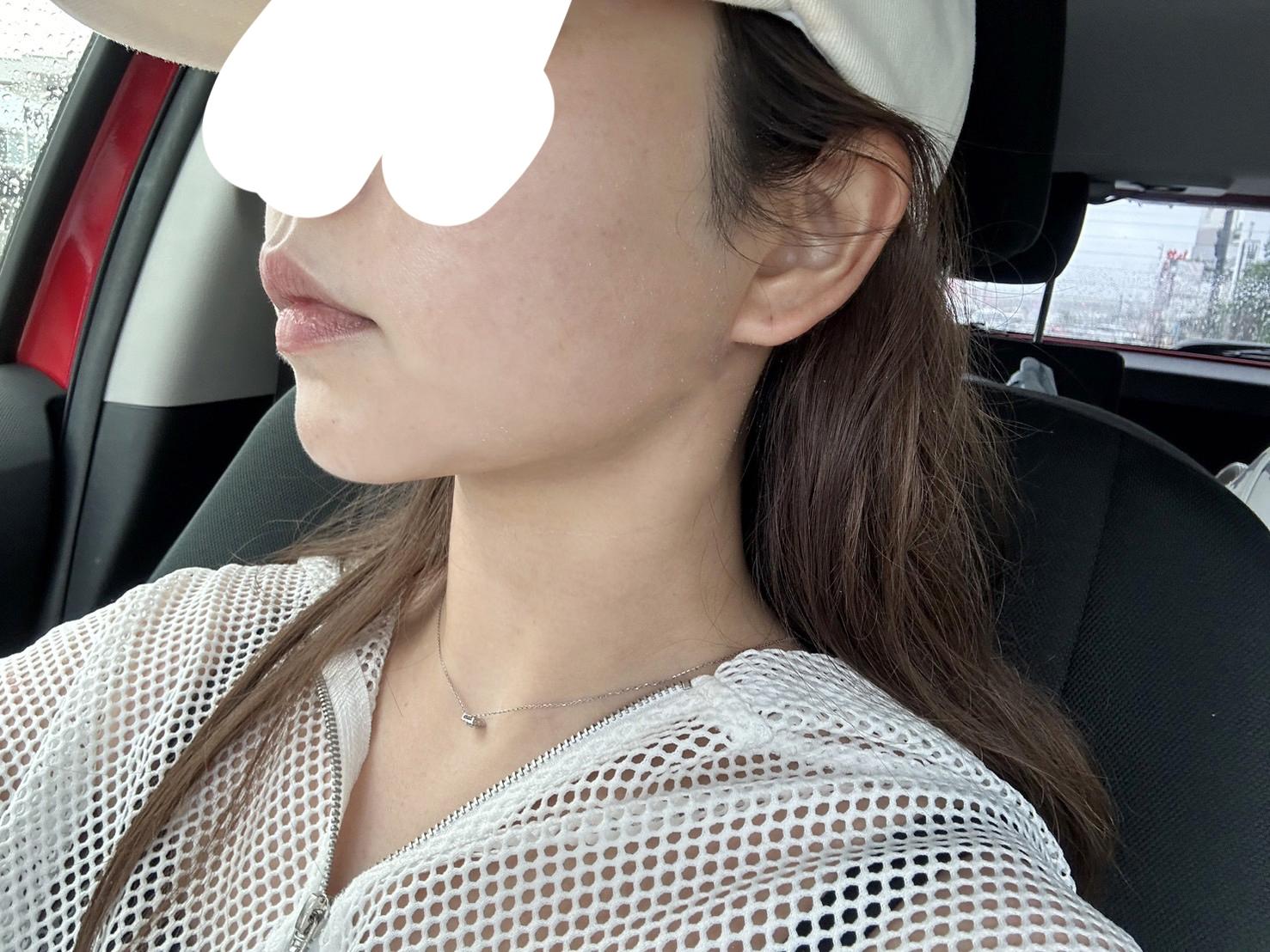 後