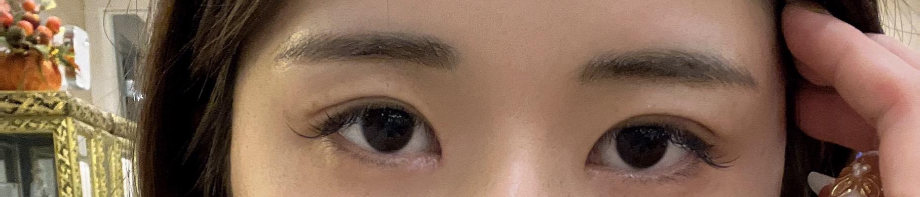 後
