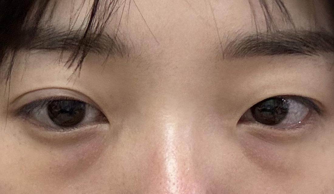 後
