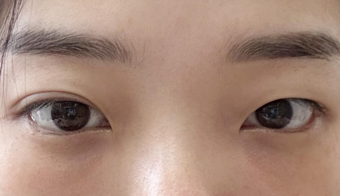 後