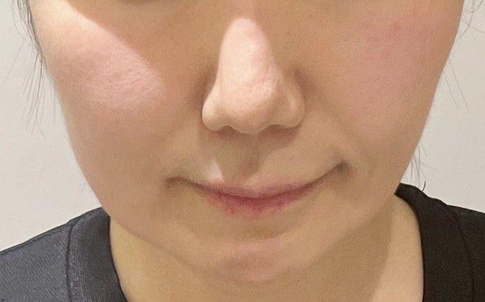 後