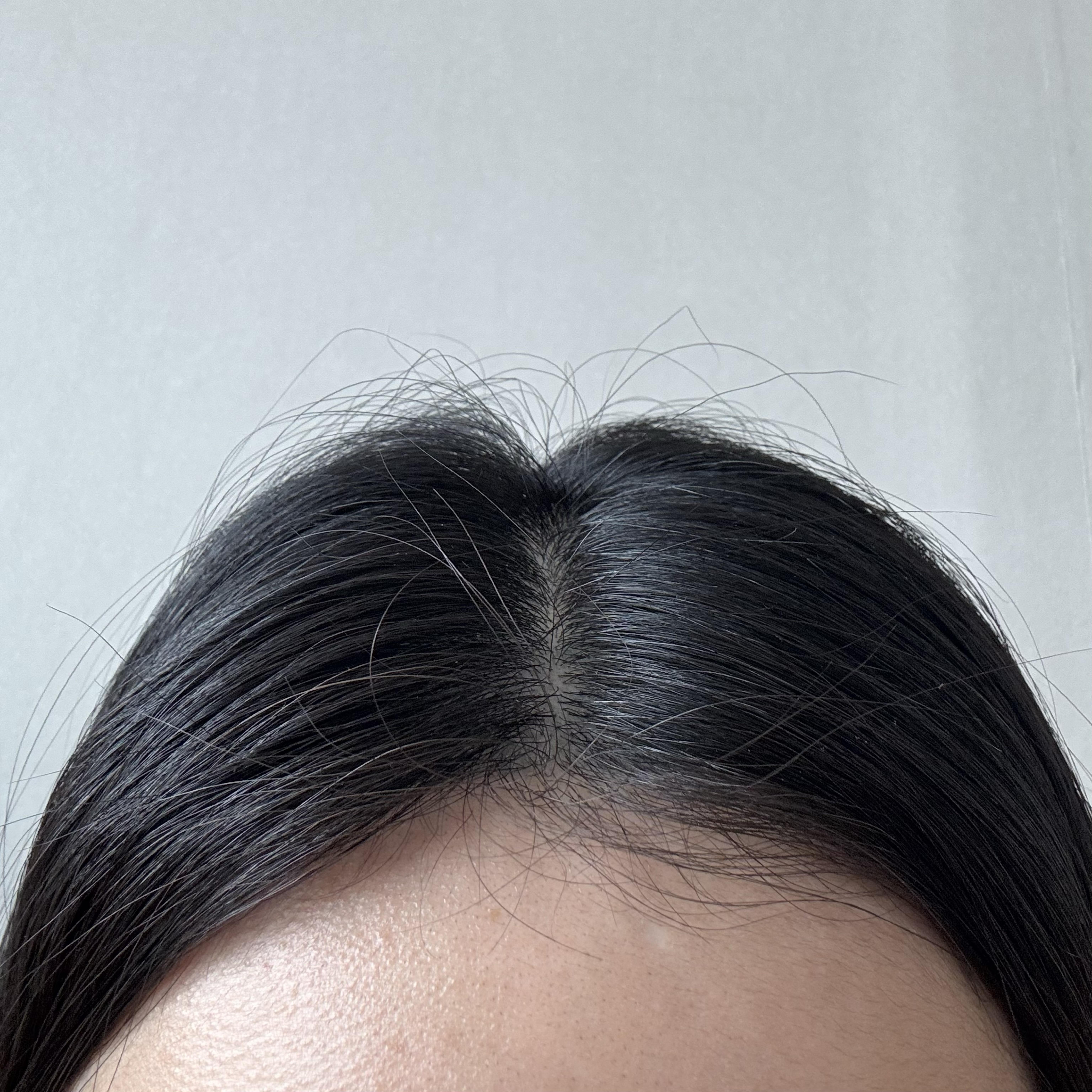 后
