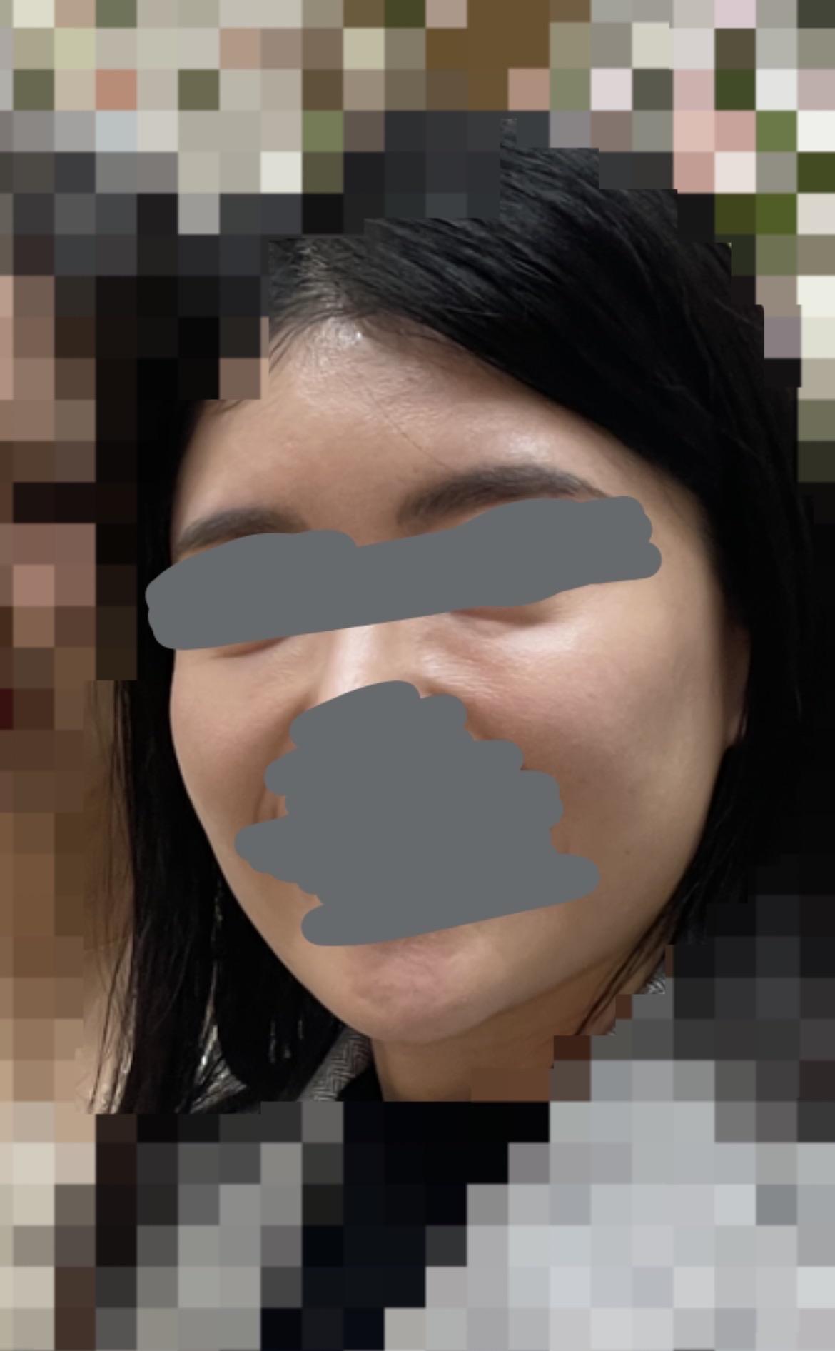 後