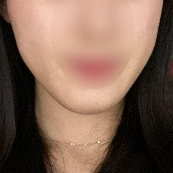 前