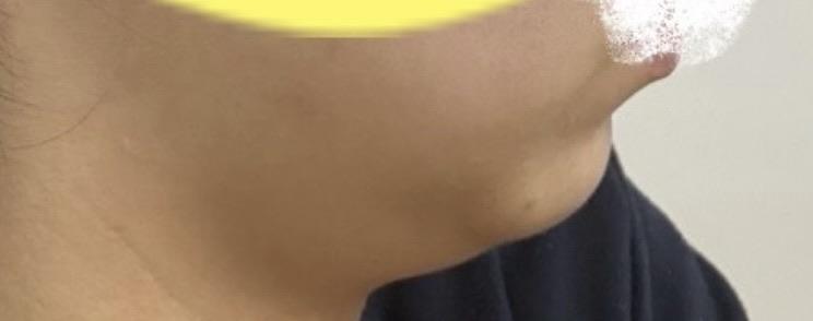 後