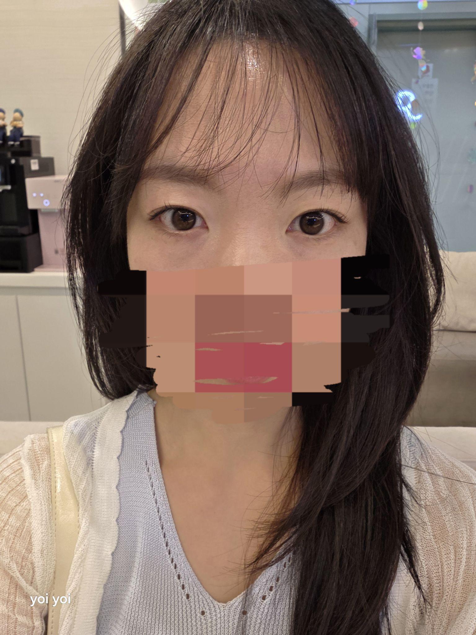 前