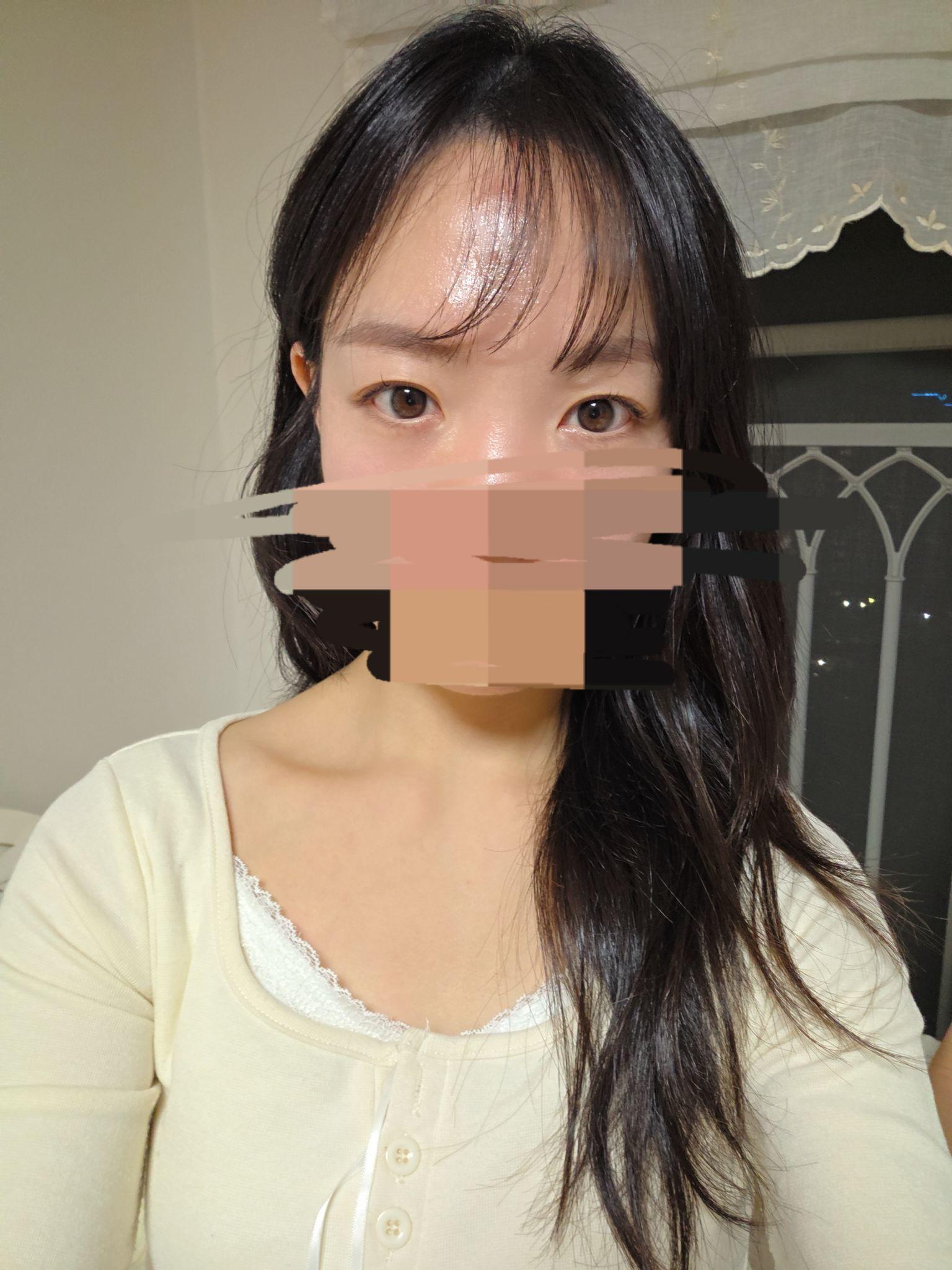 後