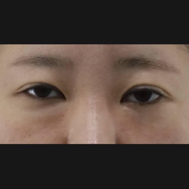 後